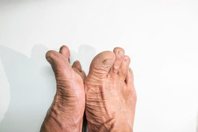 Podología geriátrica